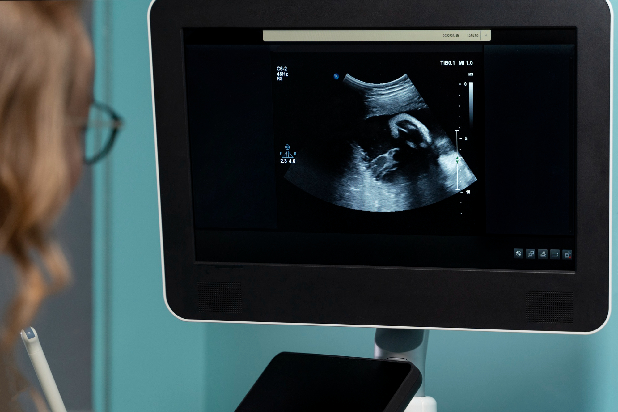 ge-healthcare-introduces-ai-powered-ultrasound-systems-for-women-s-health-diagnosis