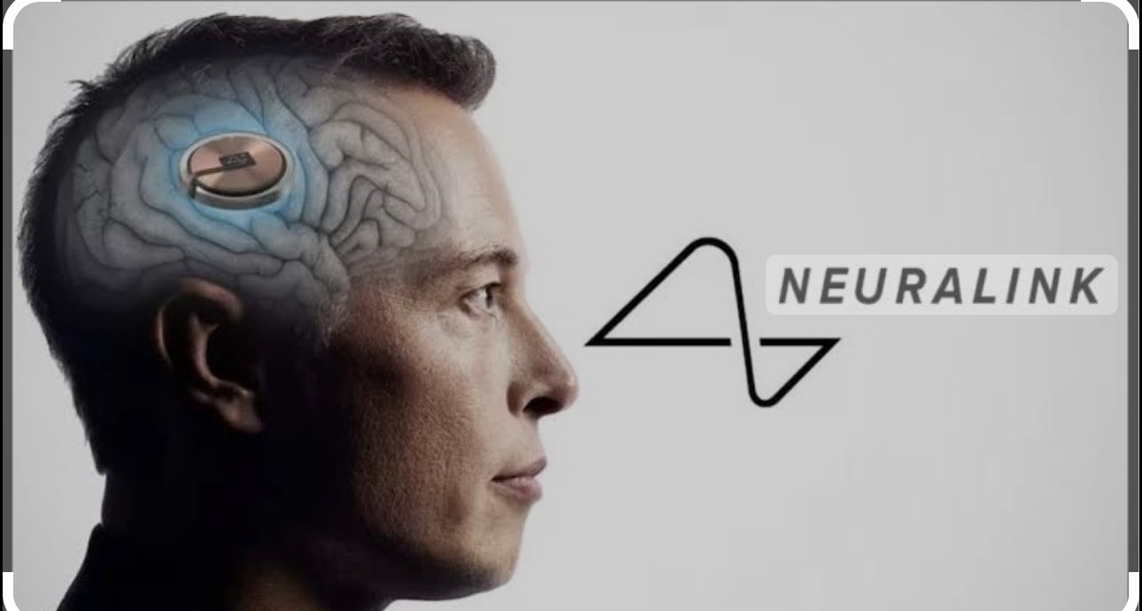 neuralink-faces-setback-as-first-human-implant-encounters-mechanical-issues